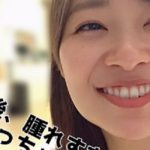 整形!? 指原莉乃の親知らず同時抜歯の理由がまさかだった・・・